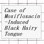 2022年論文発表|Case of Moxifloxacin-Induced Black Hairy Tongue