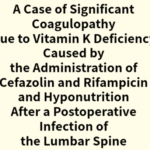 2024年論文発表|A Case of Significant Coagulopathy Due to Vitamin K Deficiency Caused by the Administration of Cefazolin and Rifampicin and Hyponutrition After a Postoperative Infection of the Lumbar Spine